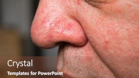  Presentation with veins - Theme enhanced with red-veins-and-acne background and a tawny brown colored foreground