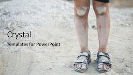  Presentation with refugee - Slide set consisting of refugee - dirty and poverty background and a light gray colored foreground