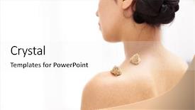  Presentation with acupuncture - Beautiful slides featuring relaxation techniques - moxibustion acupuncture needles heat backdrop and a  colored foreground