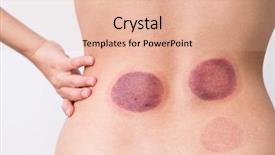  Presentation with chinese chinese - Beautiful slide deck featuring relaxation techniques - woman having chinese cupping therapy backdrop and a lemonade colored foreground