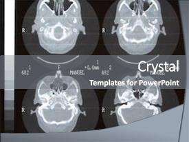  Presentation with brain - Presentation theme consisting of resonant electronics - brain tomography background and a gray colored foreground