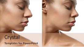  Presentation with rhinoplasty - PPT theme enhanced with rhinoplasty on white background plastic background and a coral colored foreground