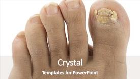  Presentation with nail cutter - Amazing slide deck having ringworm of the nail isolated backdrop and a coral colored foreground