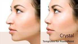  Presentation with rhinoplasty - PPT theme featuring woman before and after rhinoplasty background and a coral colored foreground