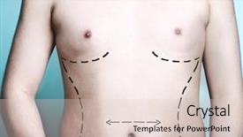  Presentation with dry pineapple close up many - Slide deck featuring s body with plastic surgery background and a lemonade colored foreground