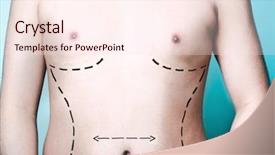  Presentation with many bubbles in water close - Colorful slide deck enhanced with s body with plastic surgery backdrop and a lemonade colored foreground