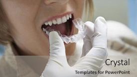  Presentation with plastic injection mould - Presentation having s hand placing plastic braces background and a light gray colored foreground