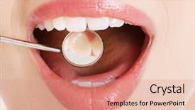  Presentation with woman covering man mouth hand - Audience pleasing PPT layouts consisting of s open mouth with dental backdrop and a coral colored foreground