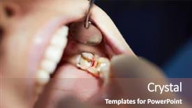  Presentation with mouth - Amazing slides having sandblasting - close-up mouth with teeth damaged backdrop and a violet colored foreground