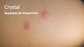  Presentation with insect aphid - Amazing PPT layouts having scabs - insect bites on female hand backdrop and a coral colored foreground