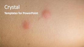  Presentation with insect - Colorful slide deck enhanced with scabs - insect bites on female hand backdrop and a coral colored foreground