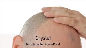  Presentation with scalp - Slides having scalp - bald adult man on white background and a coral colored foreground