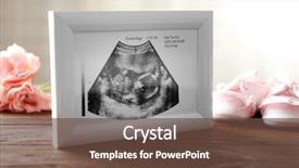  Presentation with ultrasound - Cool new PPT theme with scan of baby in frame backdrop and a tawny brown colored foreground
