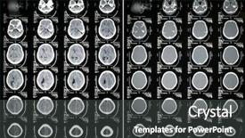 Presentation with head injury - PPT layouts with scan result - subdural hematoma brain background and a dark gray colored foreground