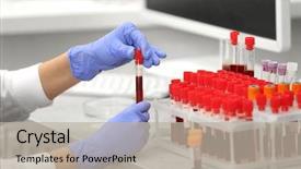  Presentation with sample - PPT layouts having scientist working with blood sample background and a mint green colored foreground