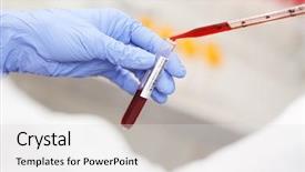  Presentation with sample - Beautiful theme featuring scientist working with blood sample backdrop and a light gray colored foreground