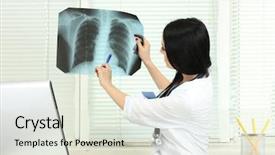  Presentation with scoliosis - Slide set featuring scoliosis - beautiful girl doctor holding x-ray background and a soft green colored foreground