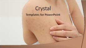  Presentation with allergy - PPT theme with scratching her shoulder with rash background and a coral colored foreground