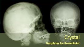  Presentation with x ray of a human - Beautiful slides featuring sculling - x-ray scull collection backdrop and a tawny brown colored foreground