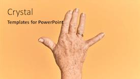  Presentation with vulcan - Slide deck featuring senior-caucasian-hand-over-yellow background and a yellow colored foreground