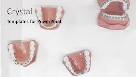  Presentation with jaw - Slide deck with set of jaw models with dental bracket on white background background and a light gray colored foreground