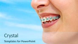  Presentation with dental - Cool new theme with showing white teeth with braces backdrop and a cool aqua colored foreground