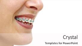  Presentation with teeth - Slide deck consisting of showing white teeth with braces background and a white colored foreground