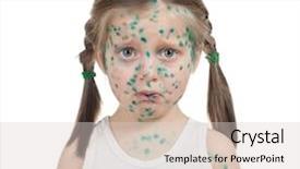  Presentation with sick child - Presentation design enhanced with sick child chickenpox isolated background and a lemonade colored foreground