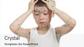  Presentation with sick child - Presentation consisting of sick child chickenpox isolated background and a  colored foreground