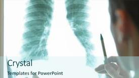  Presentation with skeletal - PPT theme having skeletal - specialist watching image of chest background and a cool aqua colored foreground