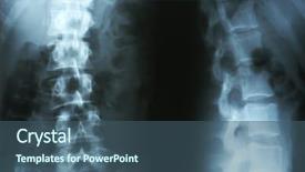  Presentation with spinal - Amazing PPT theme having skeletal - x-ray of human spinal column backdrop and a ocean colored foreground