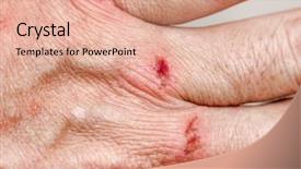  Presentation with injury - Slide set having skin abrasion injury background and a coral colored foreground