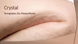  Presentation with leg anatomy - Presentation theme enhanced with skin anatomy - detail of cellulite on woman background and a lemonade colored foreground