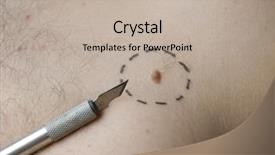  Presentation with skin cancer - Presentation theme with skin cancer - birth mark with scalpel background and a mint green colored foreground