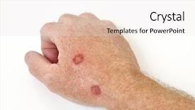  Presentation with cancer cells - PPT layouts with grand canyon at mathers point background and a tawny brown colored foreground