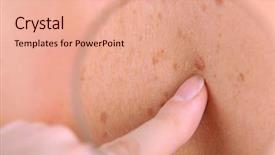  Presentation with skin cancer - Presentation consisting of skin cancer - dermatologist examines a birthmark background and a coral colored foreground