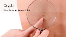  Presentation with skin cancer - Amazing theme having skin cancer - dermatologist examines a birthmark backdrop and a lemonade colored foreground