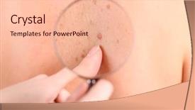  Presentation with skin cancer - Cool new theme with skin cancer - dermatologist examines a birthmark backdrop and a lemonade colored foreground