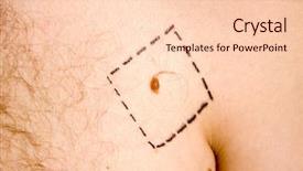  Presentation with melanoma - Colorful PPT theme enhanced with skin cancer - melanoma with surgery drawed lines backdrop and a lemonade colored foreground