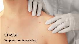  Presentation with melanoma - Audience pleasing slide set consisting of melanoma - dermatologist examining patient in clinic backdrop and a lemonade colored foreground