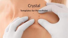  Presentation with children cancer awareness - Audience pleasing presentation theme consisting of melanoma - oncologist examining female patient closeup backdrop and a coral colored foreground