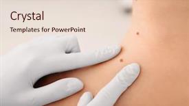  Presentation with melanoma - Amazing presentation design having melanoma - oncologist examining patient in clinic backdrop and a lemonade colored foreground