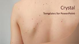  Presentation with pharmaceutical light - Presentation theme featuring mofle - young man with birthmarks background and a lemonade colored foreground