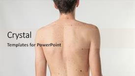  Presentation with skin - Beautiful slide set featuring skin body - young man with birthmarks backdrop and a lemonade colored foreground