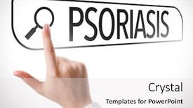  Presentation with psoriasis - PPT layouts enhanced with skin disorders - psoriasis written in search bar background and a white colored foreground