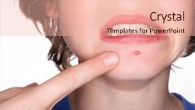  Presentation with skin infection - Presentation enhanced with skin infection - pimple background and a lemonade colored foreground