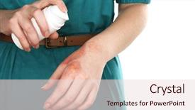  Presentation with skin infection - Audience pleasing slide set consisting of skin infection - treatment of burns by spray backdrop and a lemonade colored foreground