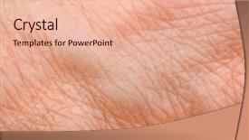  Presentation with skin - Audience pleasing slides consisting of skin macro on 40 years backdrop and a lemonade colored foreground