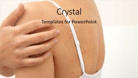  Presentation with allergy - Slide set enhanced with skin rash - allergy concept woman scratching her background and a lemonade colored foreground