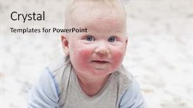  Presentation with dermatitis - Cool new slides with skin rash - little baby with dermatitis backdrop and a lemonade colored foreground